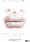 Папиллиопластика (2018)