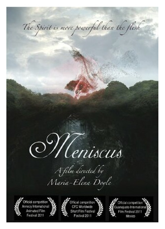 мультик Meniscus (2010) 16.08.22
